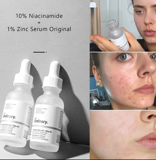 The Ordinary - Niacinamide 10% + Zinc 1% - 30ml
