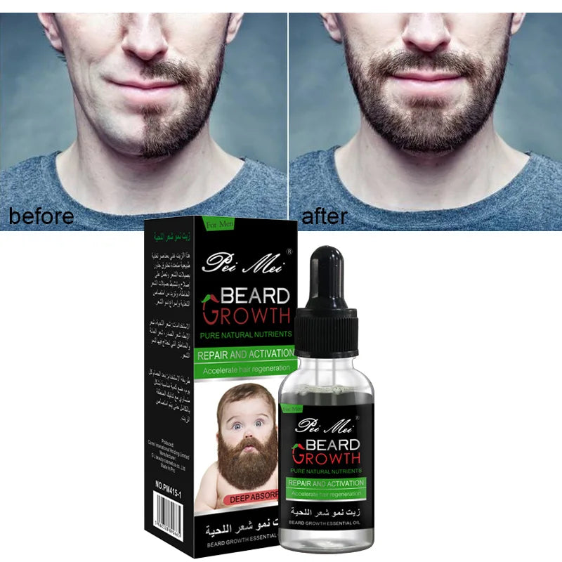 Natural Organic Beard Oil For Mustache Growth & Hair Loss Treatment