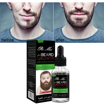 Natural Organic Beard Oil For Mustache Growth & Hair Loss Treatment